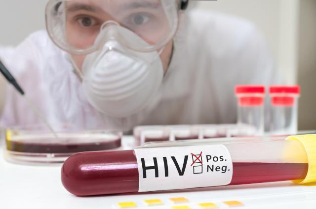 Stvoreno antitelo koje uništava 99% svih tipova HIV-a